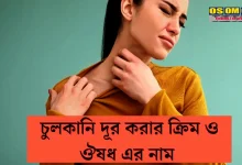 সারা গায়ে চুলকানি ঔষধ
