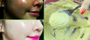 কালো থেকে ফর্সা হওয়ার উপায়
